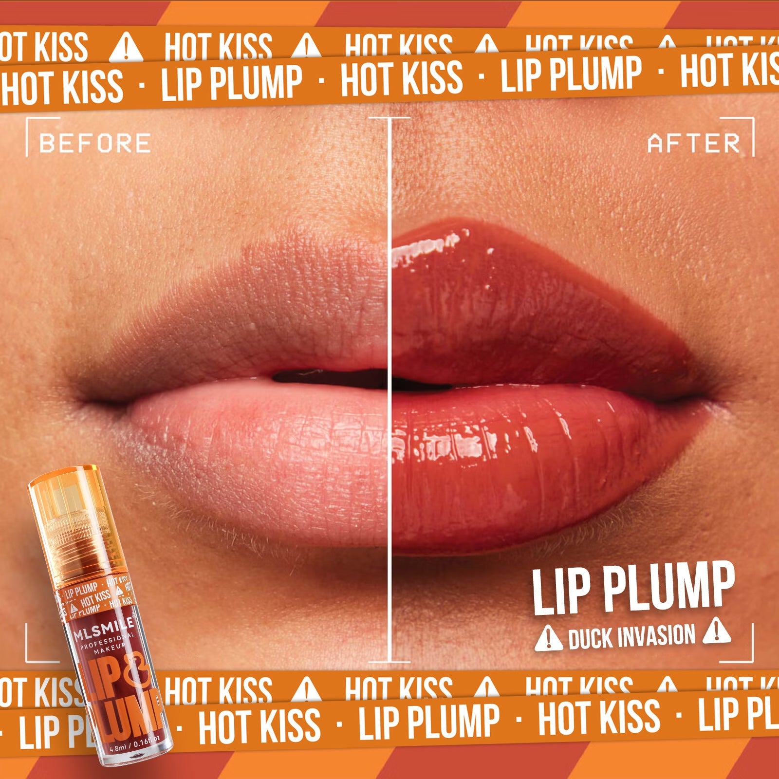 Lip Care